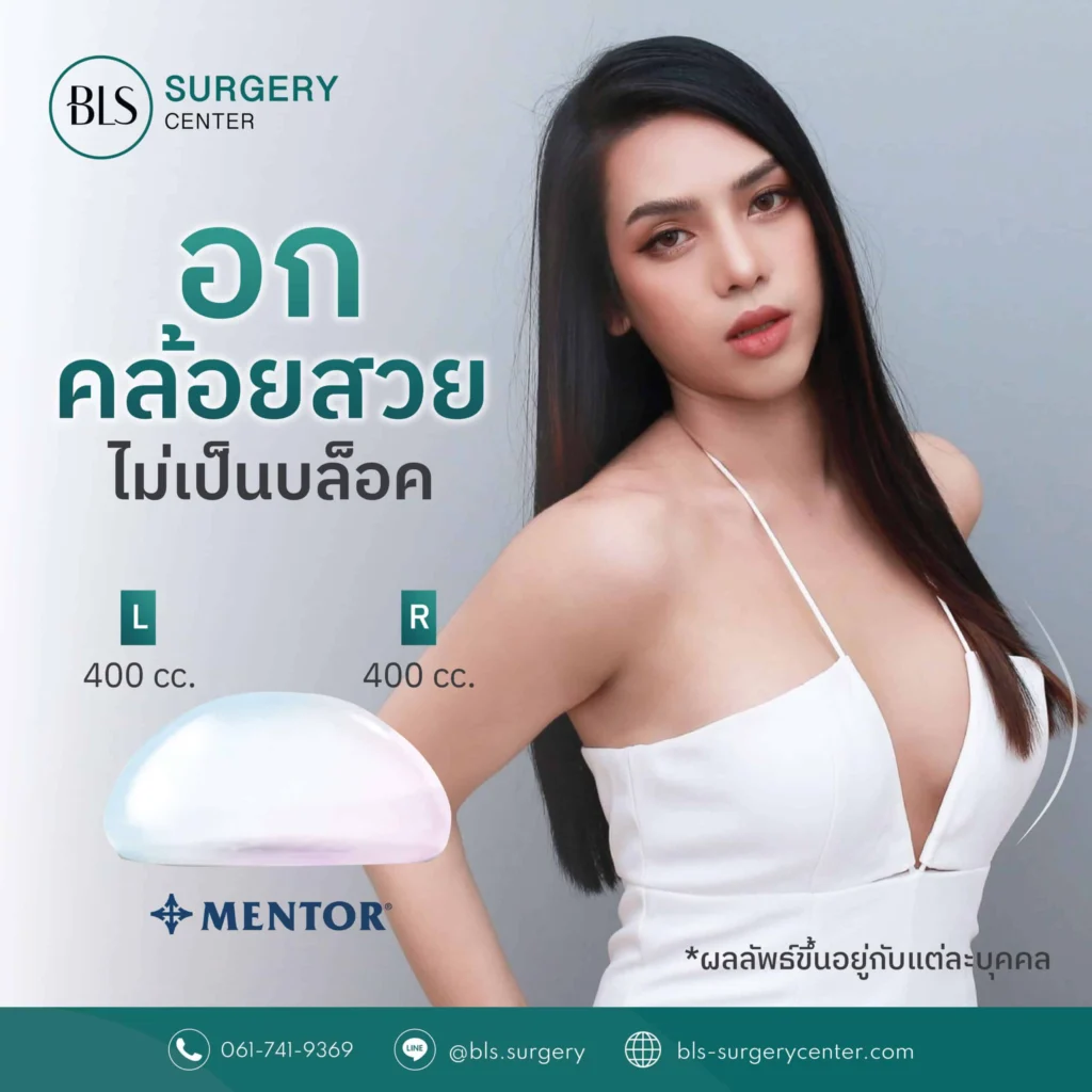 Mentor Silicone Implants