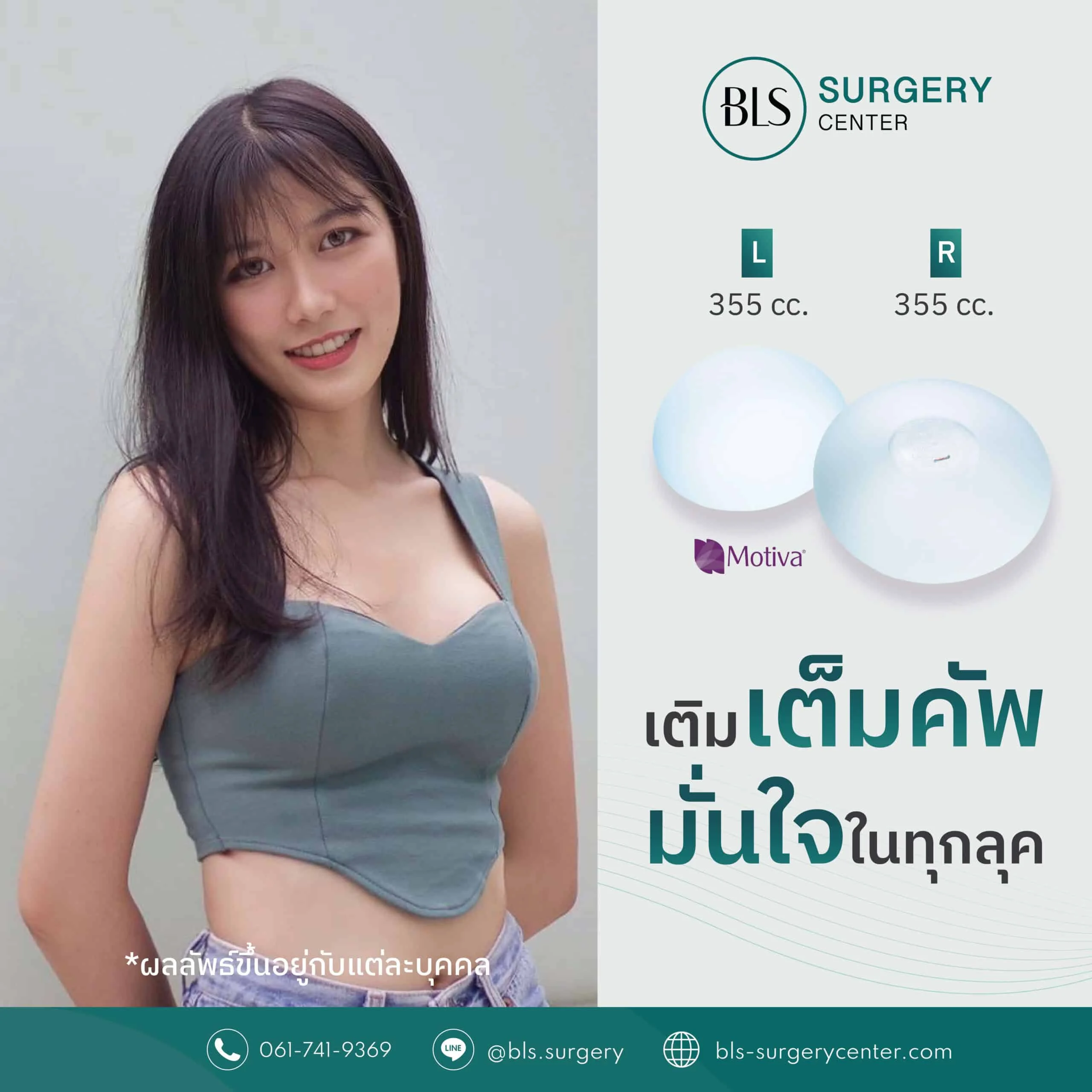 ซิลิโคน Motiva