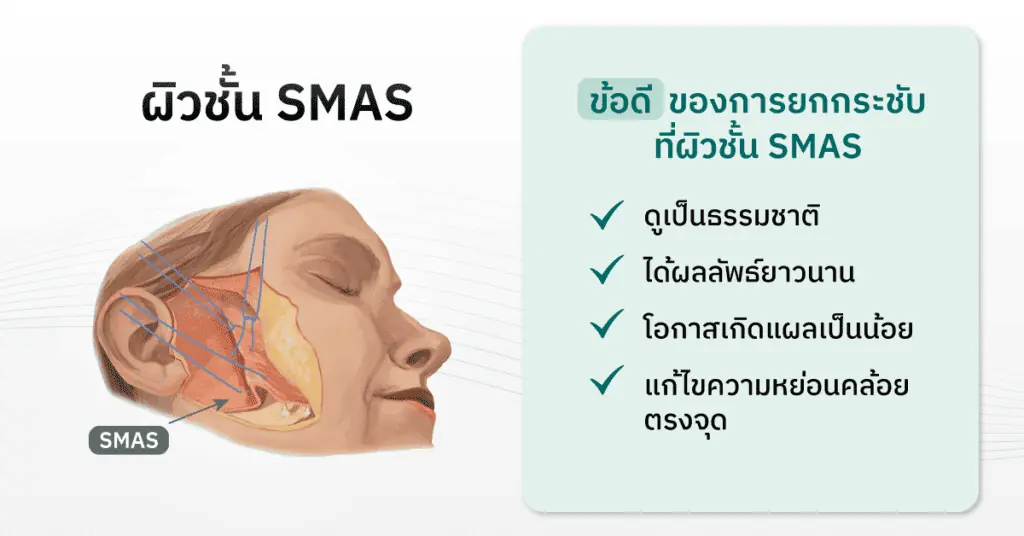 รูปผิวชั้น SMAS