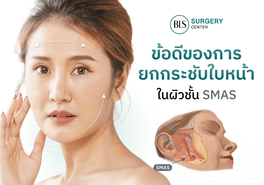 ข้อดีของการยกกระชับใบหน้าในผิวชั้น SMAS