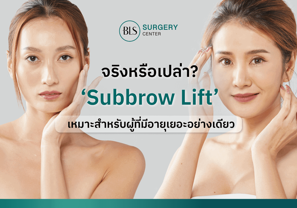 ‘Subbrow Lift’ แก้ปัญหาหนังตาตก เหมาะผู้ที่มีอายุเยอะอย่างเดียว จริงหรือไม่?
