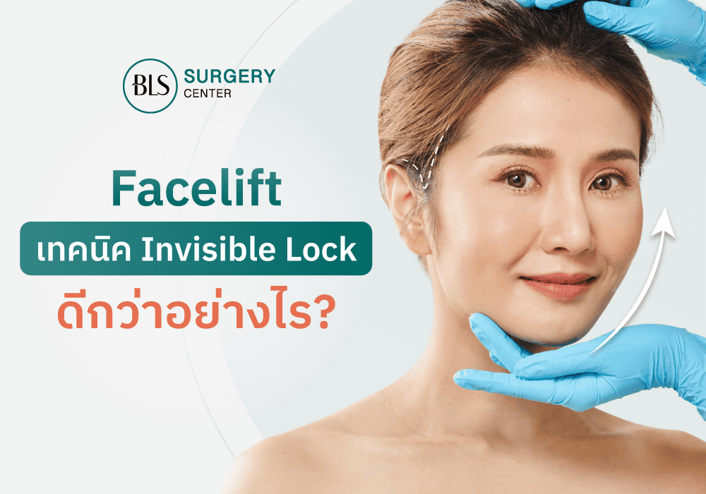 การผ่าตัดยกกระชับใบหน้า ด้วย Facelift + Invisible Lock ดีกว่าอย่างไร?