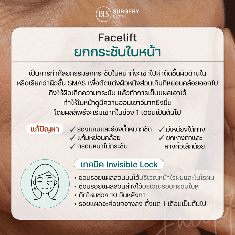 ยกกระชับใบหน้า Facelift ช่วยจัดการ ผิวหย่อนคล้อย ได้ดีหรือไม่