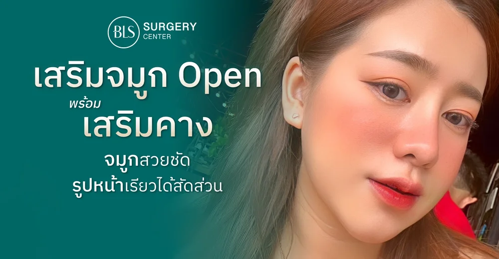 เสริมจมูกแบบโอเพ่น พร้อมเสริมคาง จมูกสวยชัด รูปหน้าเรียวได้สัดส่วน