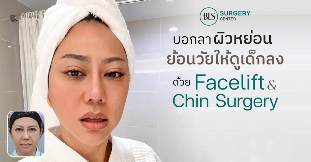บอกลา หน้าหย่อนคล้อย ย้อนวัยให้ดูเด็กลง ด้วย Facelift & Chin Surgery