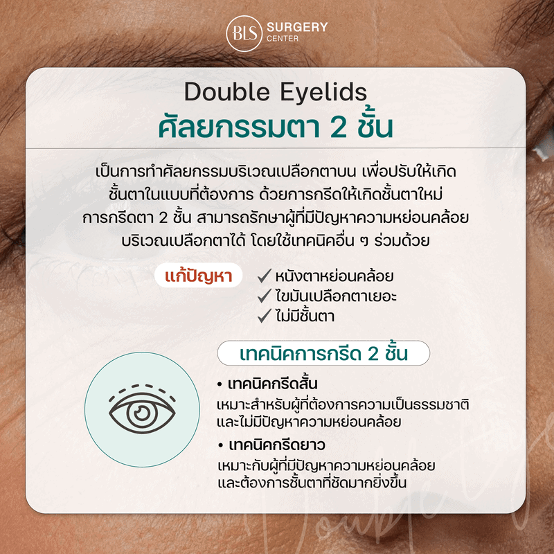 ศัลยกรรมตา2ชั้น Double Eyelid