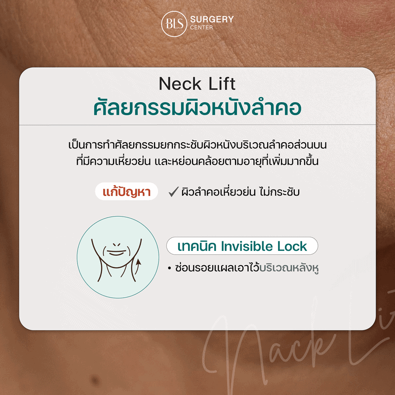 ศัลยกรรมผิวหนังลำคอ Neck Lift