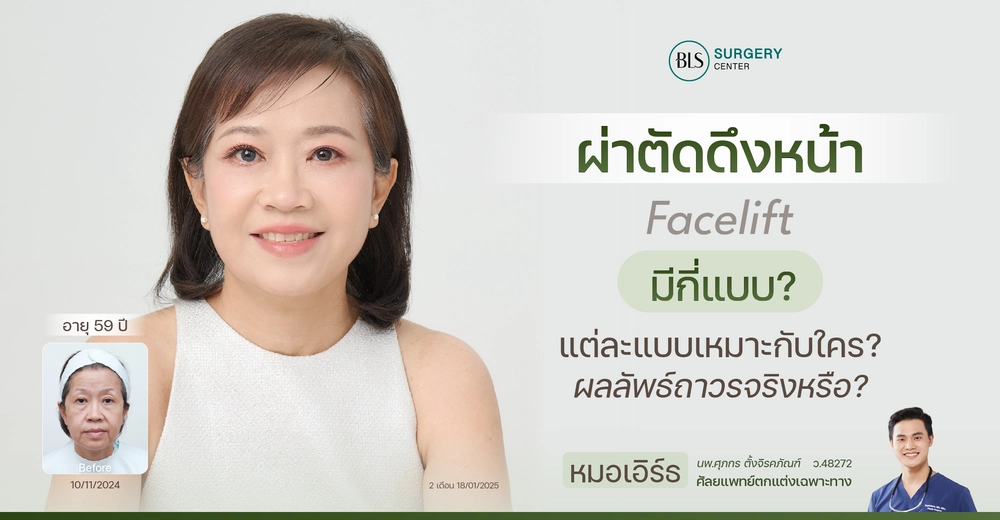 ผ่าตัดดึงหน้า คืออะไร มีกี่แบบ แบบไหนเหมาะกับใคร ผลลัพธ์คงอยู่ถาวรจริงหรือ?