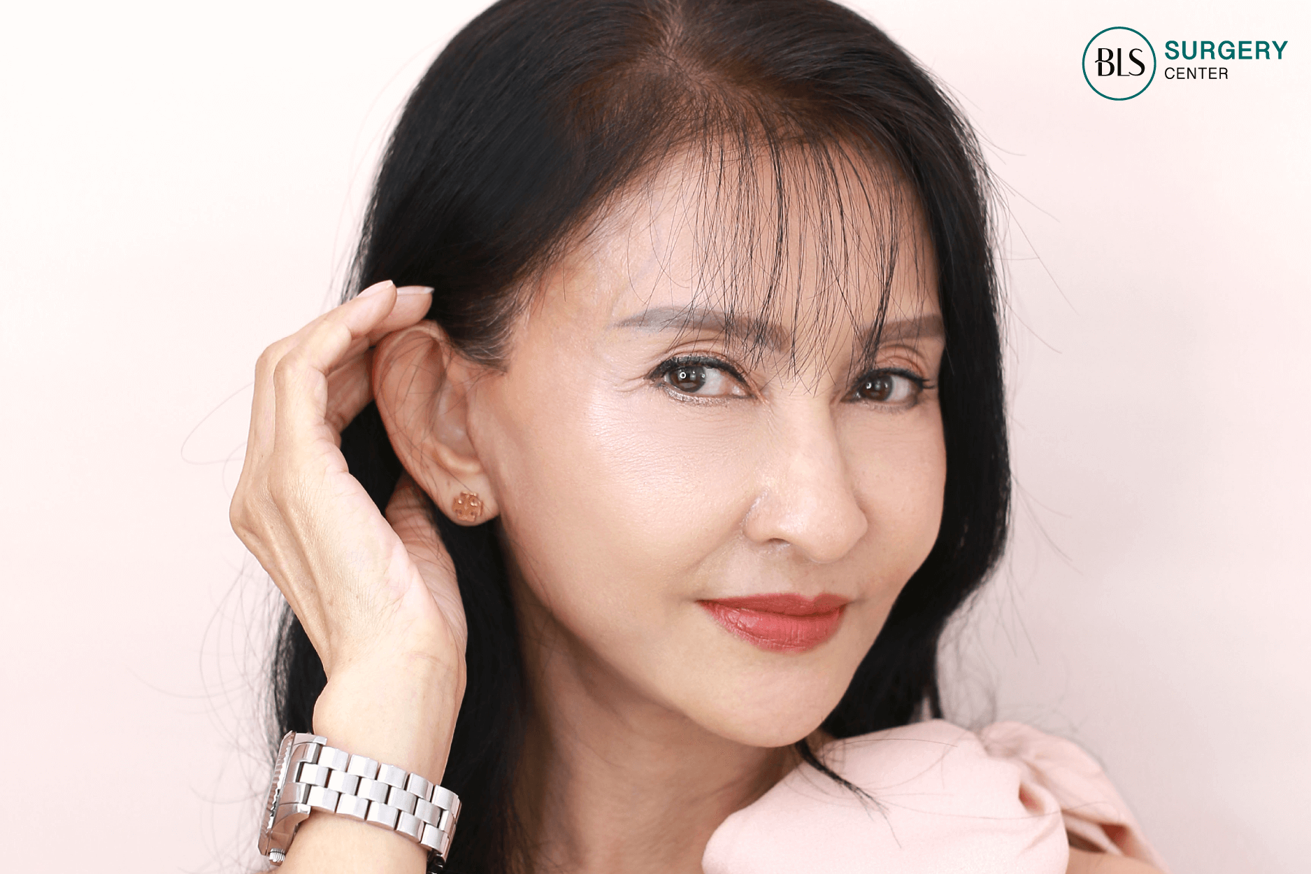 หลังทำ Facelift & Necklift 3 เดือน ผิวหน้ากระชับ ลดหย่อนคล้อย ไม่เห็นรอยแผล