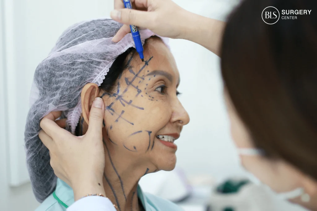 Before Facelift & Necklift – designed together with board-certified surgeons