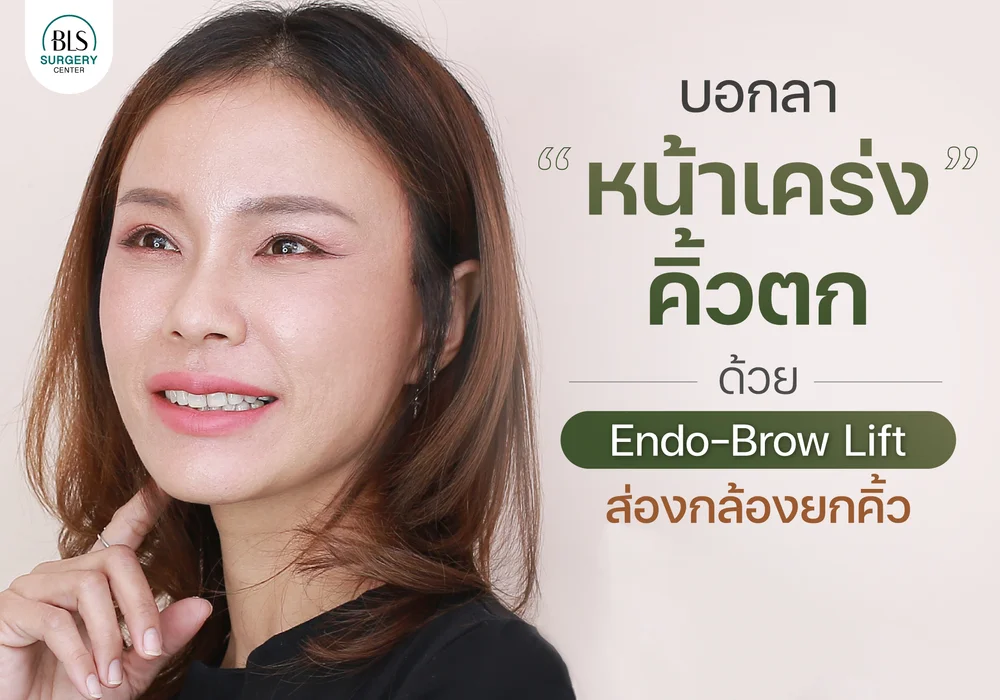 หน้าเคร่ง คิ้วตก” ด้วย Endo-Brow Lift ส่องกล้องยกคิ้ว