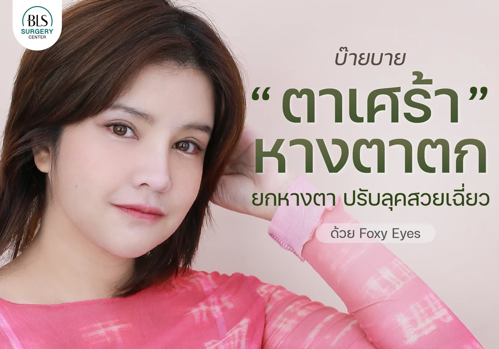 บ๊ายบาย “ตาเศร้า หางตาตก” ยกหางตา ปรับลุคสวยเฉี่ยว ด้วย Foxy Eyes