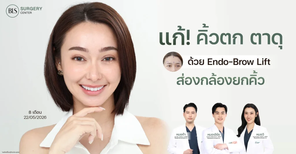 ผ่าตัดยกคิ้ว แก้คิ้วตก ตาดุ ด้วย Endo-Brow Lift ส่องกล้องยกคิ้ว