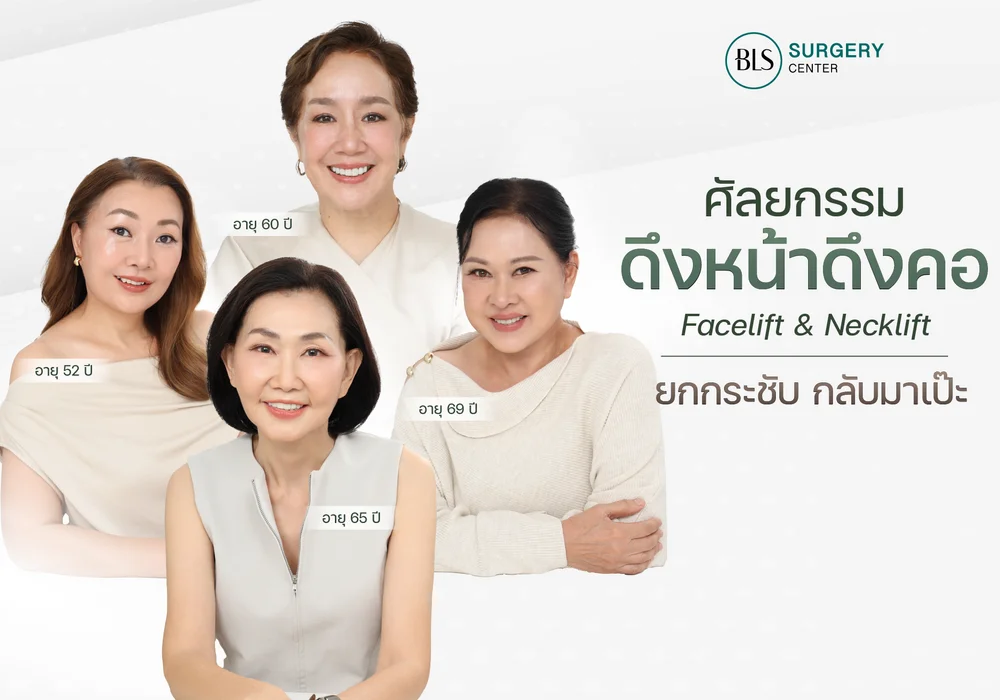 ผ่าตัดดึงหน้า (Face lift) ยกกระชับหน้า กลับมาเป๊ะ