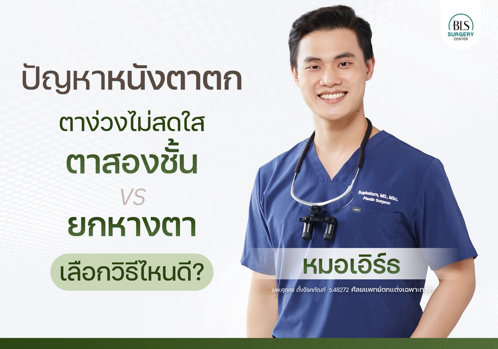 หนังตาตก หางตาตก ตาง่วงไม่สดใส ทำตาสองชั้น VS ยกหางตา เลือกวิธีไหนดี?