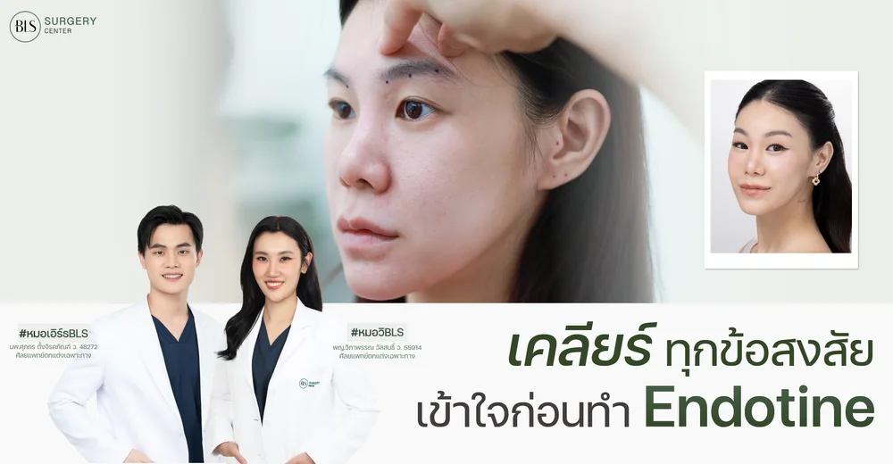 เคลียร์ทุกข้อสงสัย เข้าใจก่อนทำ เอนโดไทน์ Endotine | BLS Surgery Center