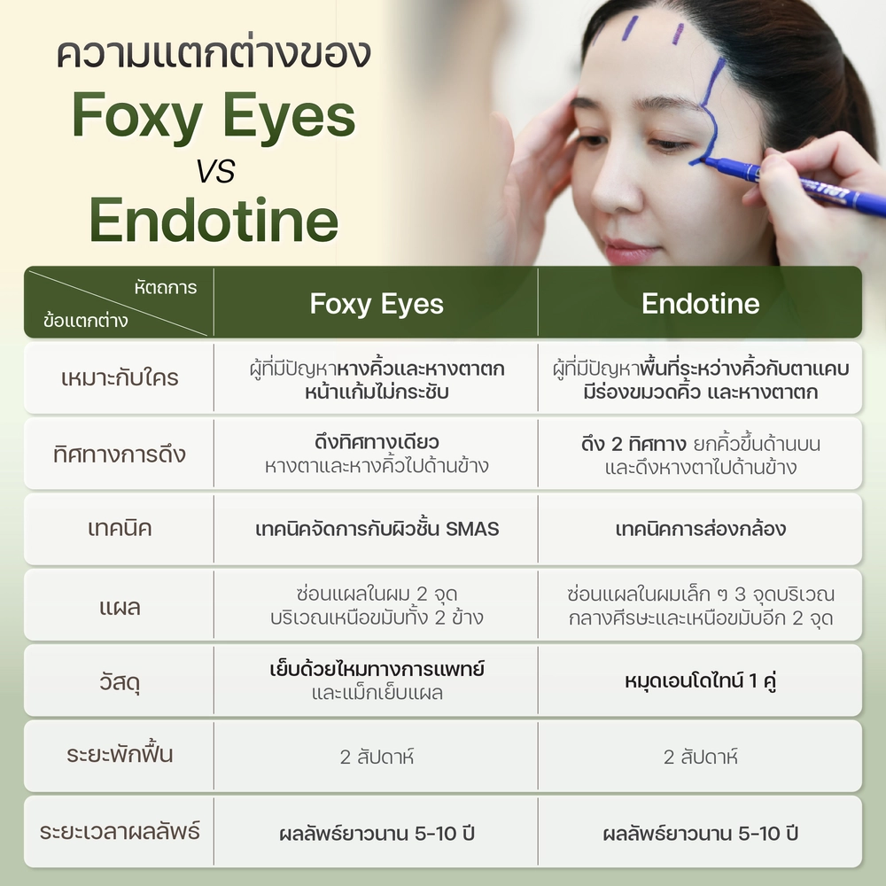 ความแตกต่างของ Foxy Eyes VS เอนโดไทน์ (Endotine)