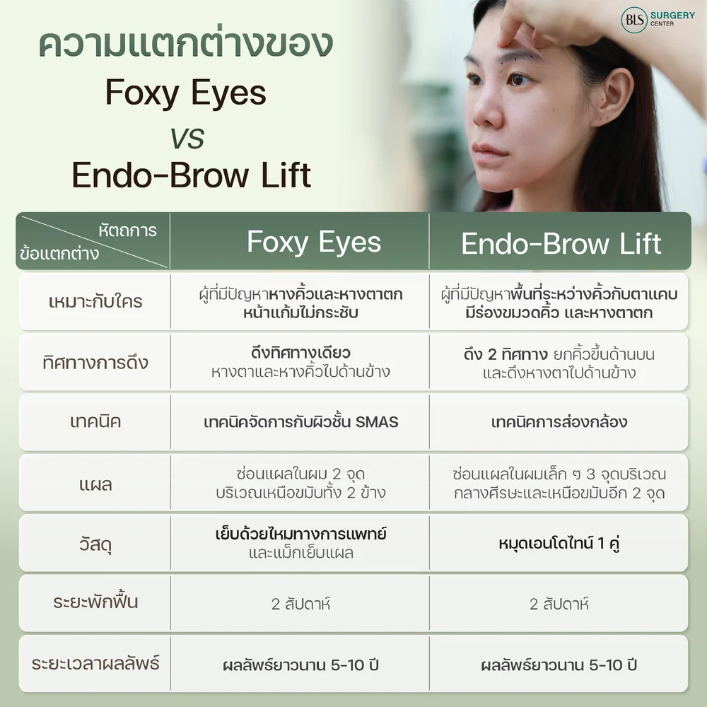 Differences between Foxy Eyes vs. Endotine (Endotine)