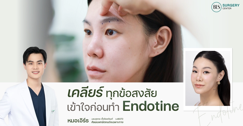 เคลียร์ทุกข้อสงสัย เข้าใจก่อนทำ เอนโดไทน์ Endotine | BLS Surgery Center