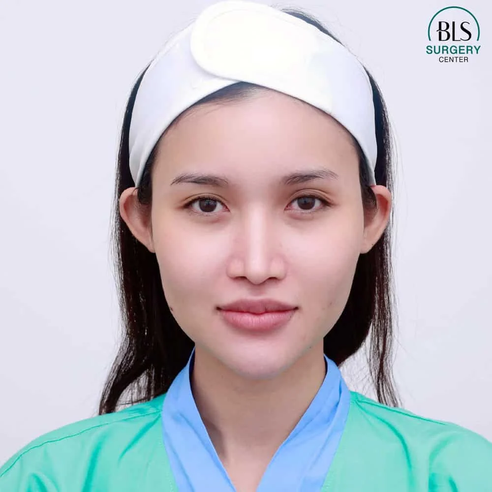 Who is Endotine Brow Lift suitable for?