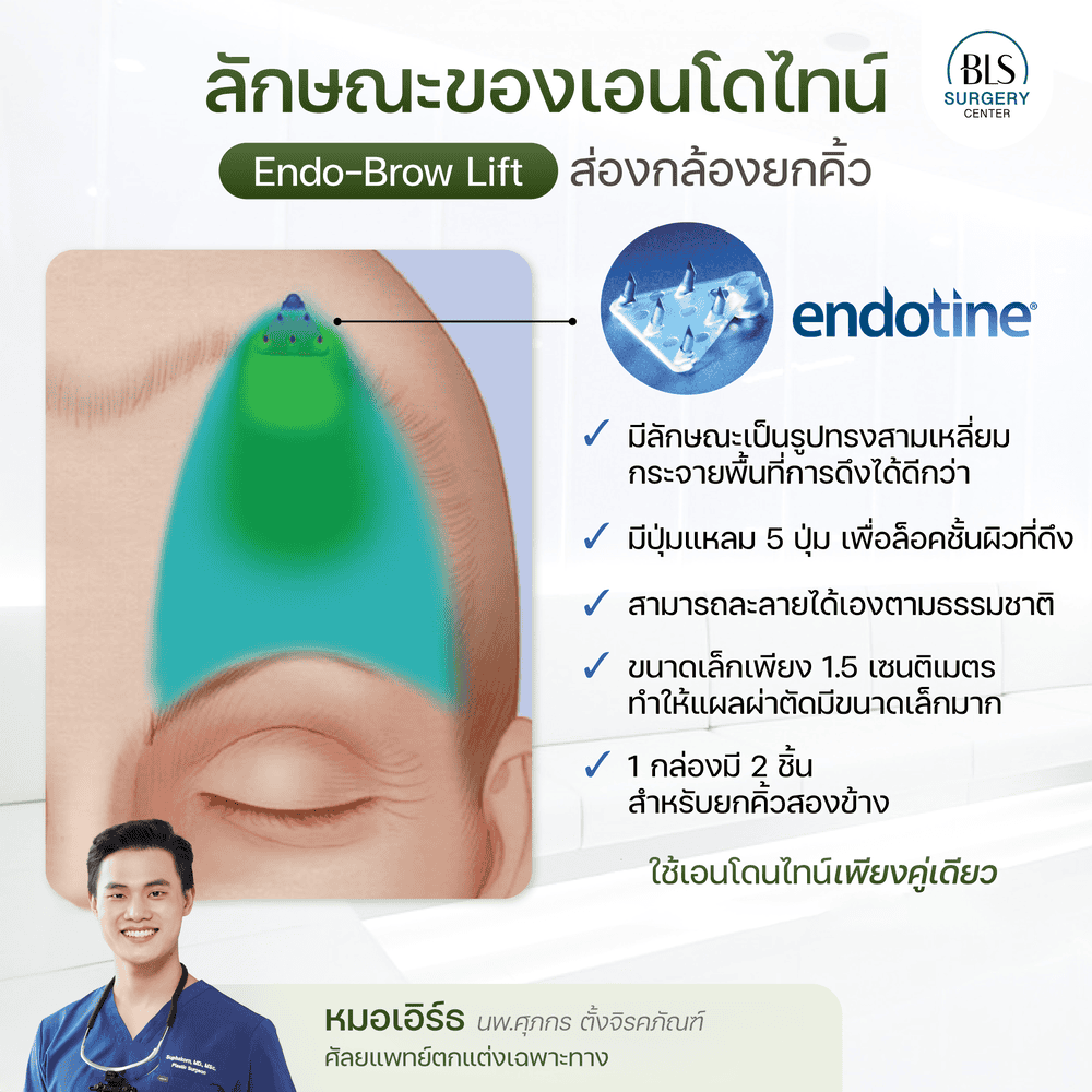 Endotine คืออะไร? มีลักษณะเป็นอย่างไร?