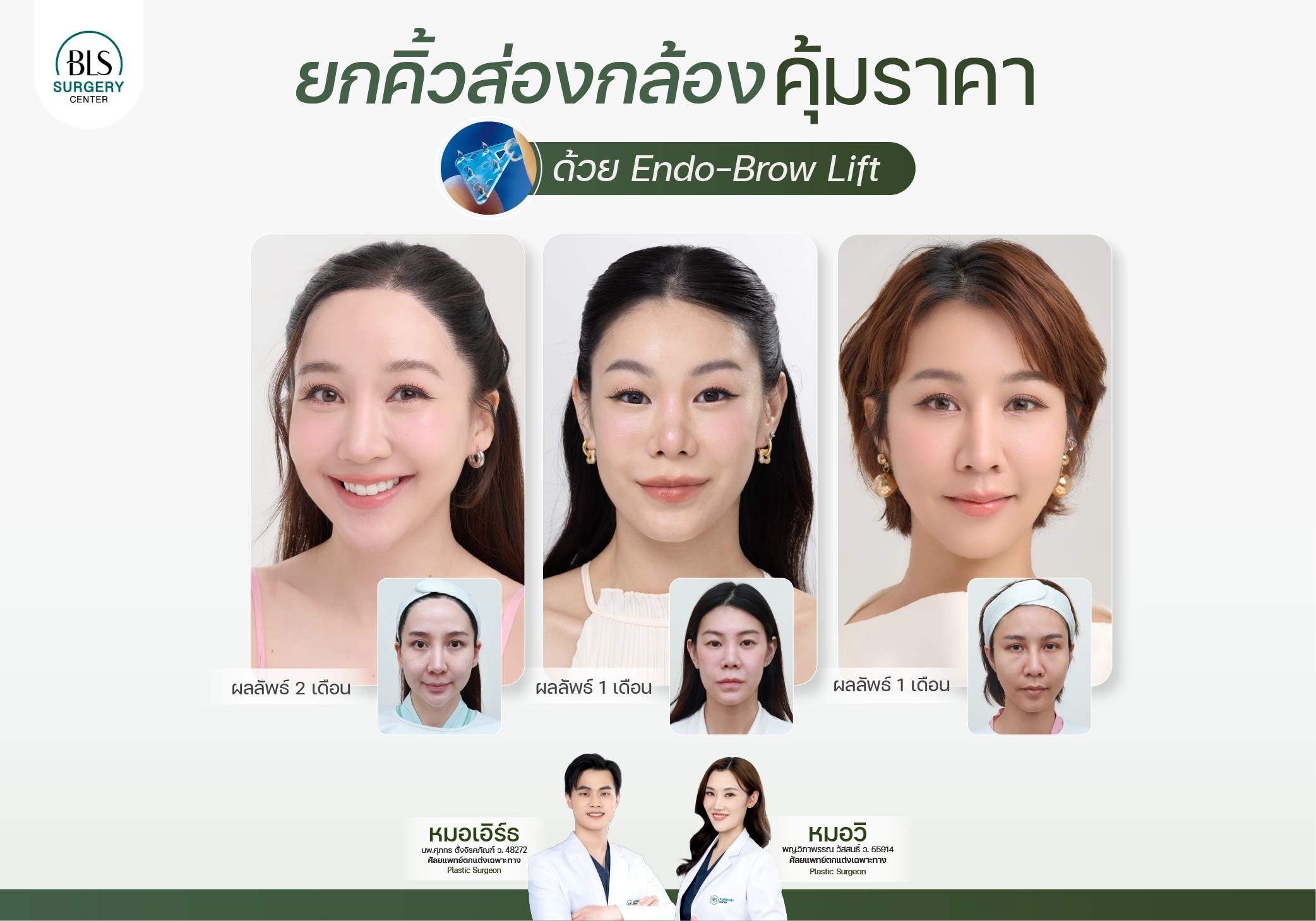 ยกคิ้วส่องกล้อง ราคาคุ้มค่า | ยกคิ้ว Endotine ที่ BLS Surgery Center