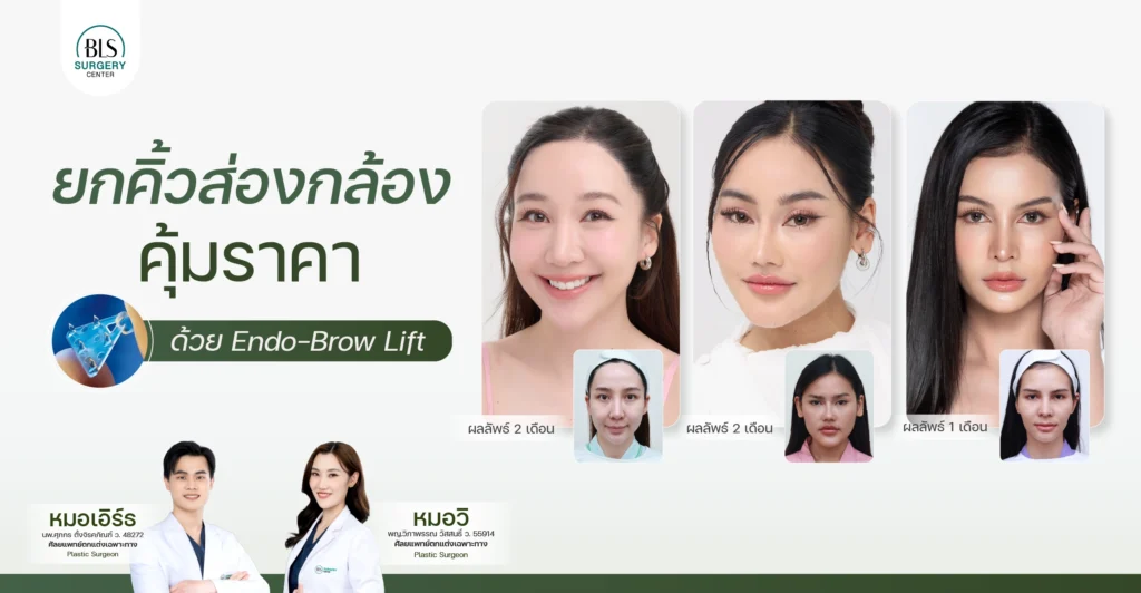 ยกคิ้วส่องกล้อง ราคาคุ้มค่า | ยกคิ้ว Endotine ที่ BLS Surgery Center