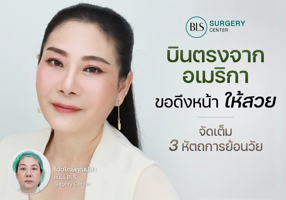 ศัลยกรรมดึงหน้า (Face lift) จัดเต็ม 3 หัตถการย้อนวัย "รีวิวโดย คุณปลา"