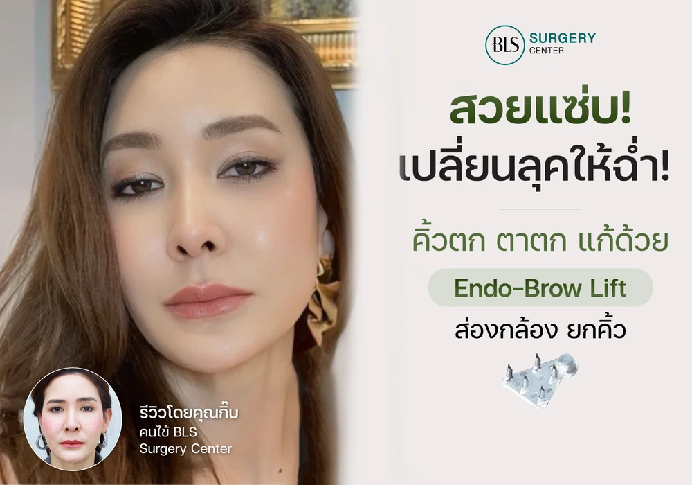 สวยแซ่บ! เปลี่ยนลุคให้ฉ่ำ! คิ้วตก ตาตก แก้ด้วย Endo-Brow Lift ส่องกล้องยกคิ้ว