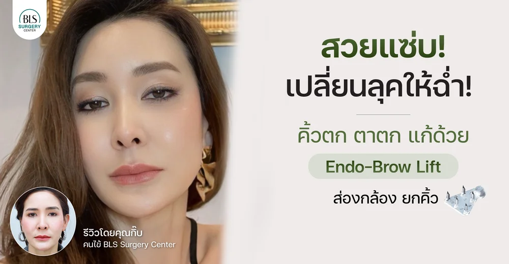 สวยแซ่บ! เปลี่ยนลุคให้ฉ่ำ! คิ้วตก ตาตก แก้ด้วย Endo-Brow Lift ส่องกล้องยกคิ้ว
