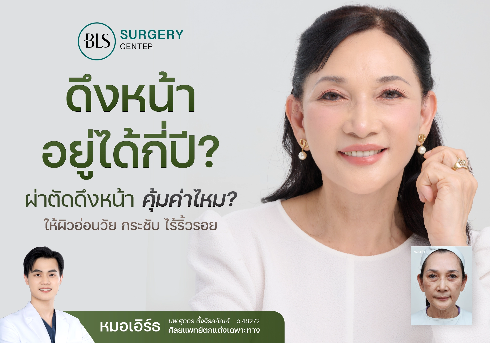 ดึงหน้า Face Lift อยู่ได้กี่ปี? ผ่าตัดดึงหน้า คุ้มค่าไหม?