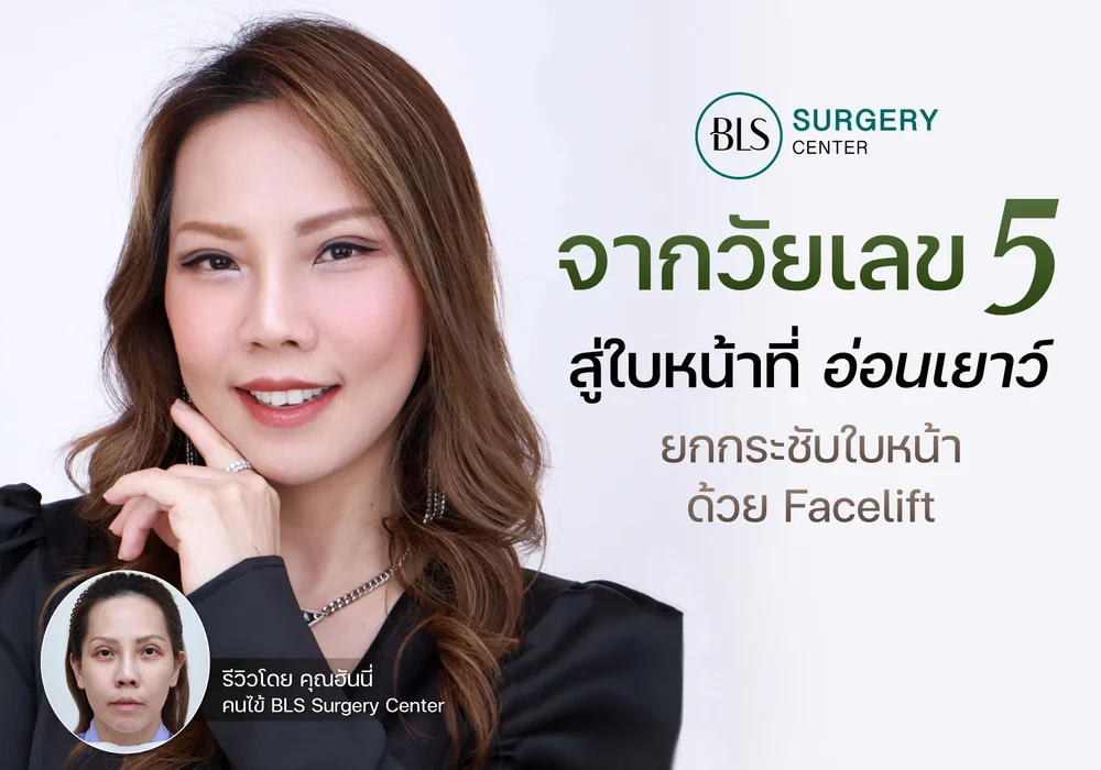 จากวัยเลข 5 สู่ใบหน้าที่อ่อนเยาว์ ยกกระชับใบหน้าด้วย Face Lift