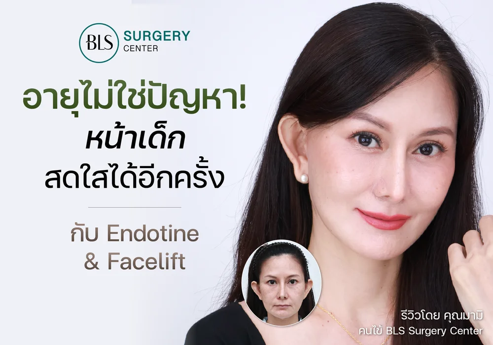 อายุไม่ใช่ปัญหา หน้าเด็ก สดใสได้อีกครั้ง ด้วย Endotine & Face Lift