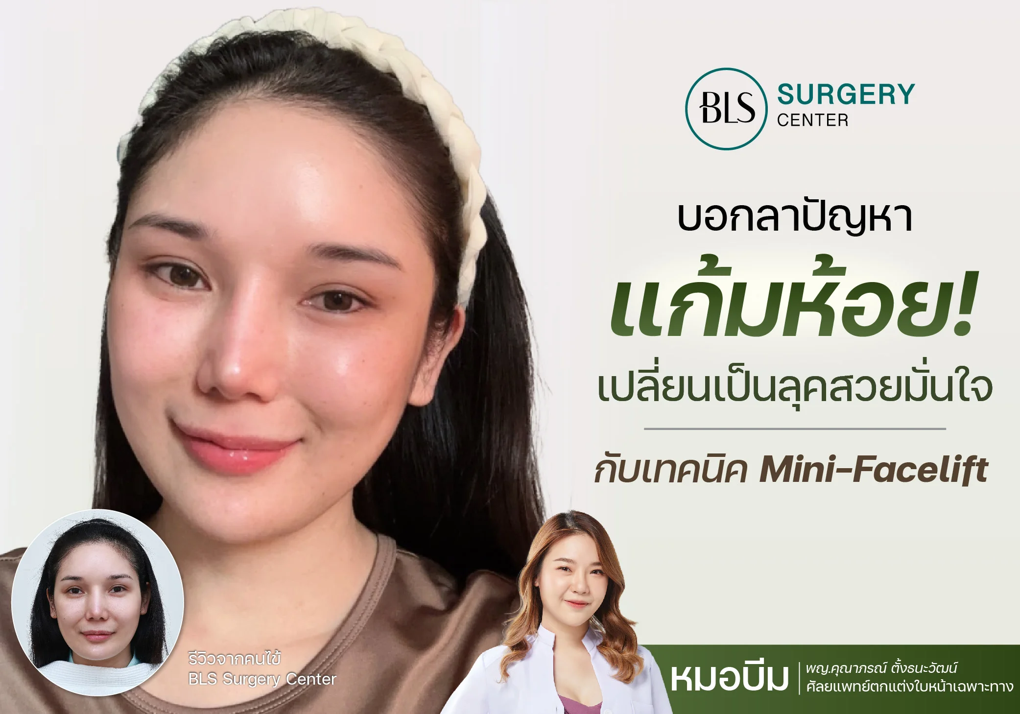 บอกลาแก้มห้อย! เปลี่ยนเป็นลุคสวยมั่นใจ ด้วยศัลยกรรมยกกระชับหน้า Mini-Facelift