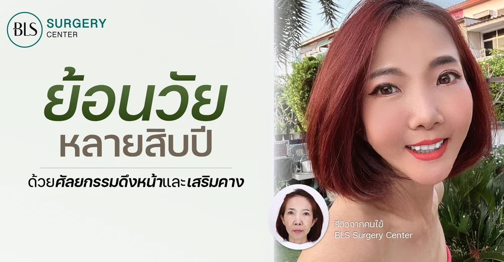 รีวิว ศัลยกรรมดึงหน้า และเสริมคาง