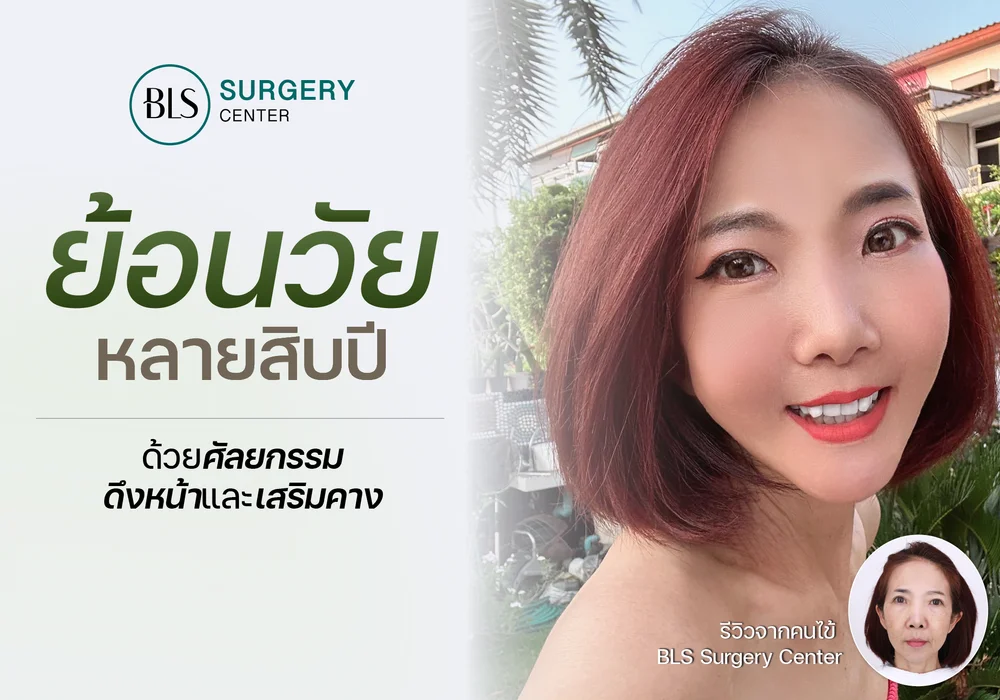 รีวิว ศัลยกรรมดึงหน้า และเสริมคาง