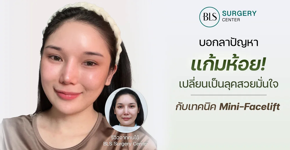 บอกลาแก้มห้อย! เปลี่ยนเป็นลุคสวยมั่นใจ ด้วยศัลยกรรมยกกระชับหน้า Mini-Facelift