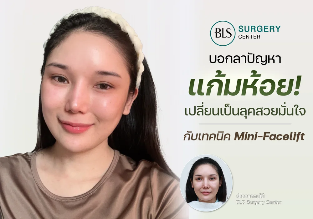 บอกลาแก้มห้อย! เปลี่ยนเป็นลุคสวยมั่นใจ ด้วยศัลยกรรมยกกระชับหน้า Mini-Facelift