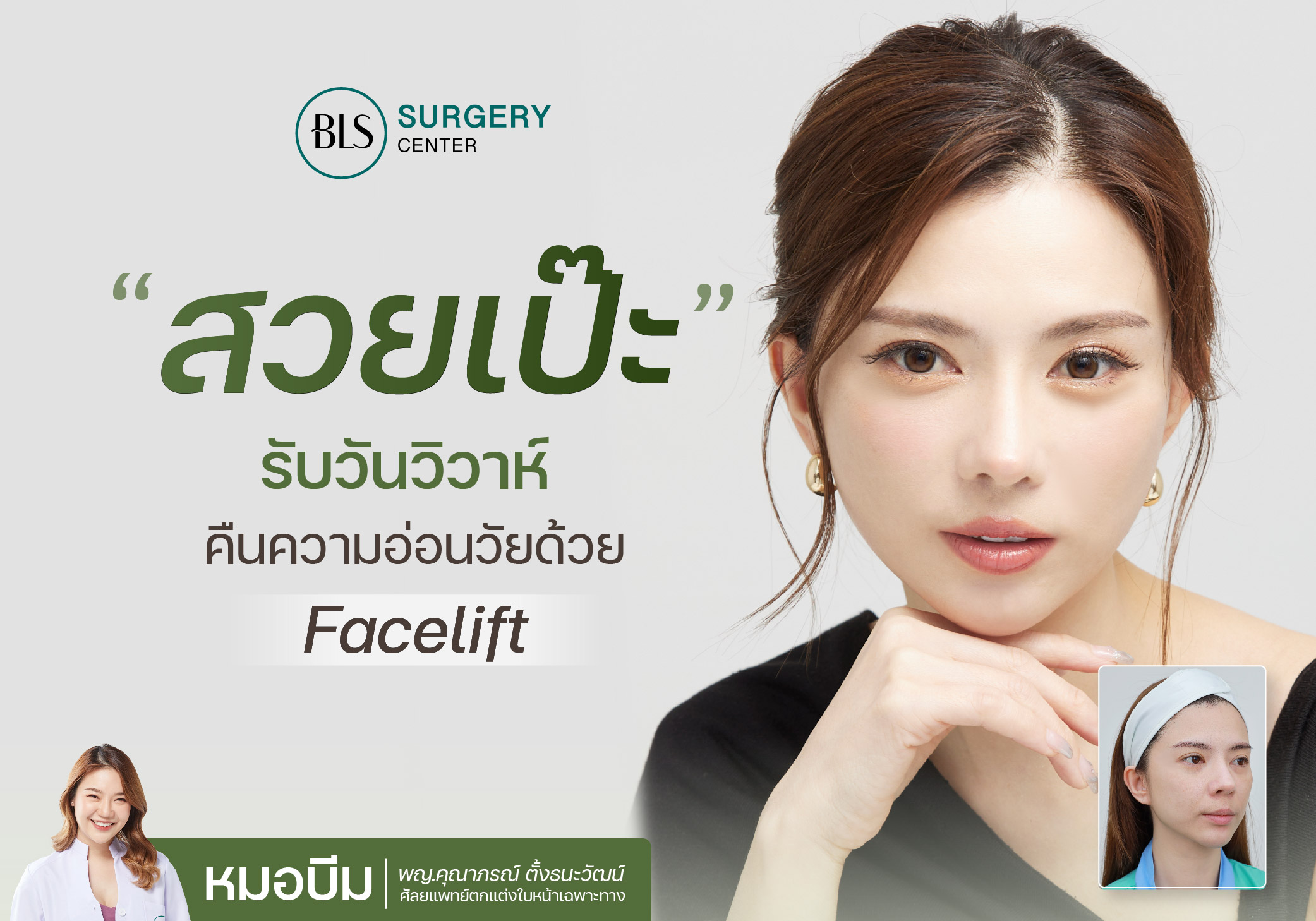 สวยเป๊ะรับวันวิวาห์ คืนความสดใส อ่อนเยาว์ ด้วย Face Lift ดึงหน้าเทคนิคซ่อนแผล