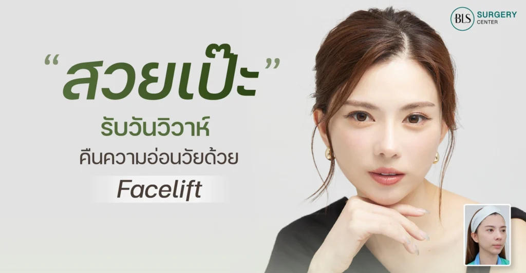 สวยเป๊ะรับวันวิวาห์ คืนความสดใส อ่อนเยาว์ ด้วย Face Lift ดึงหน้าเทคนิคซ่อนแผล