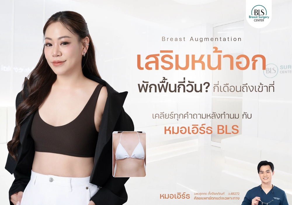 เสริมหน้าอกพักฟื้นกี่วัน กี่เดือนถึงเข้าที่