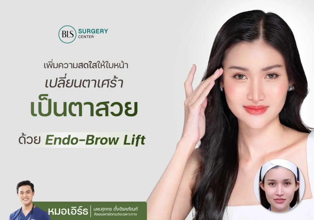 เพิ่มความสดใสให้ใบหน้า เปลี่ยนตาเศร้าเป็นตาสวย ด้วย Endo-Brow lift