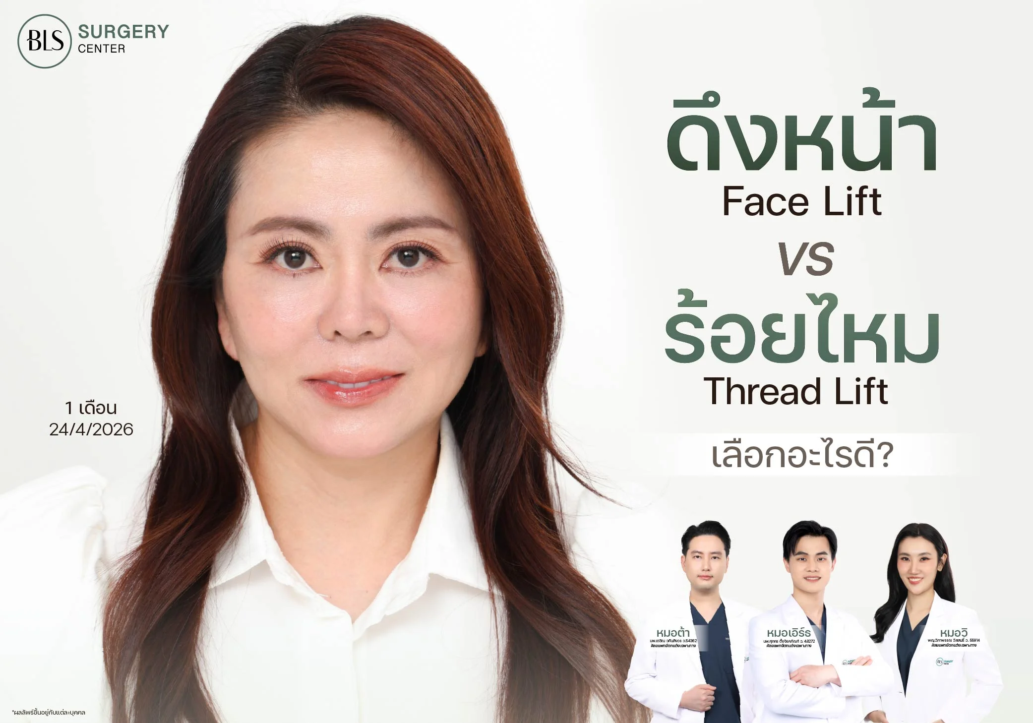 ดึงหน้า (Face Lift) VS ร้อยไหม (Thread Lift) เลือกอะไรดี?