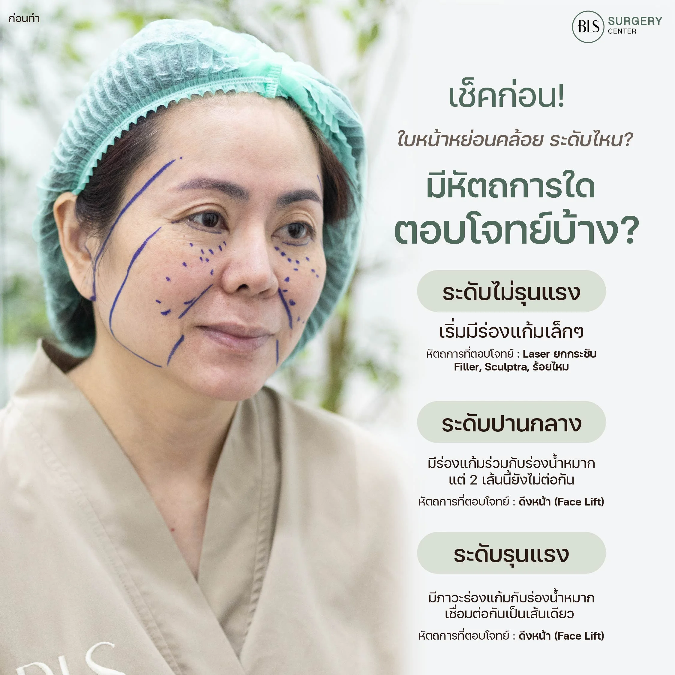หน้าหย่อนคล้อยระดับไหน ดึงหน้าหรือ ร้อยไหม ดี