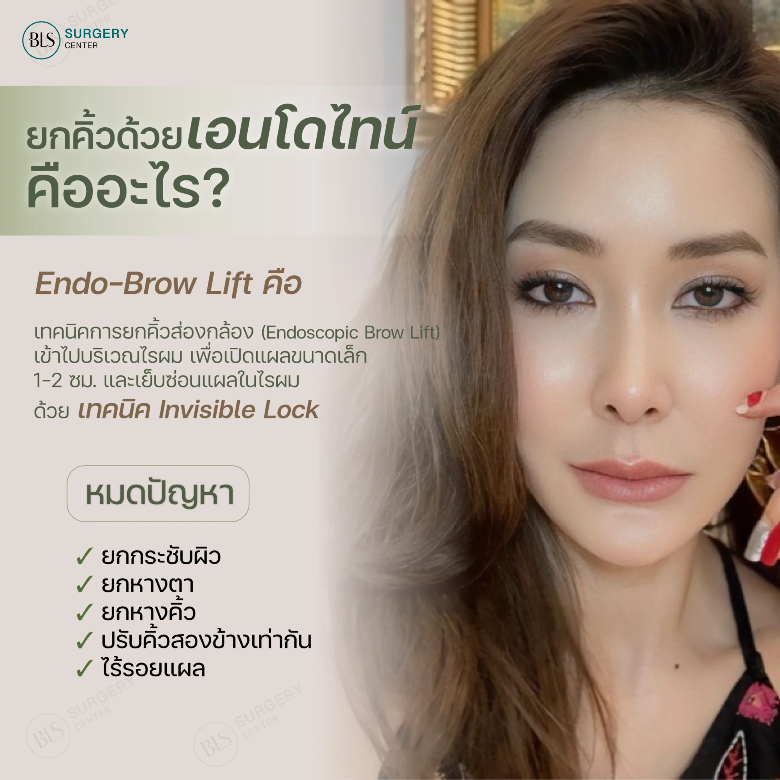 ยกคิ้ว เอนโดไทน์ คืออะไร?