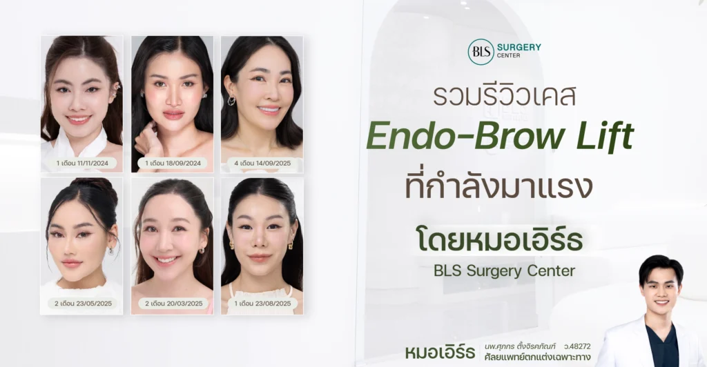 รวมรีวิวเคสเอนโดไทน์ ที่กำลังมาแรง โดยหมอเอิร์ธ BLS Surgery Center