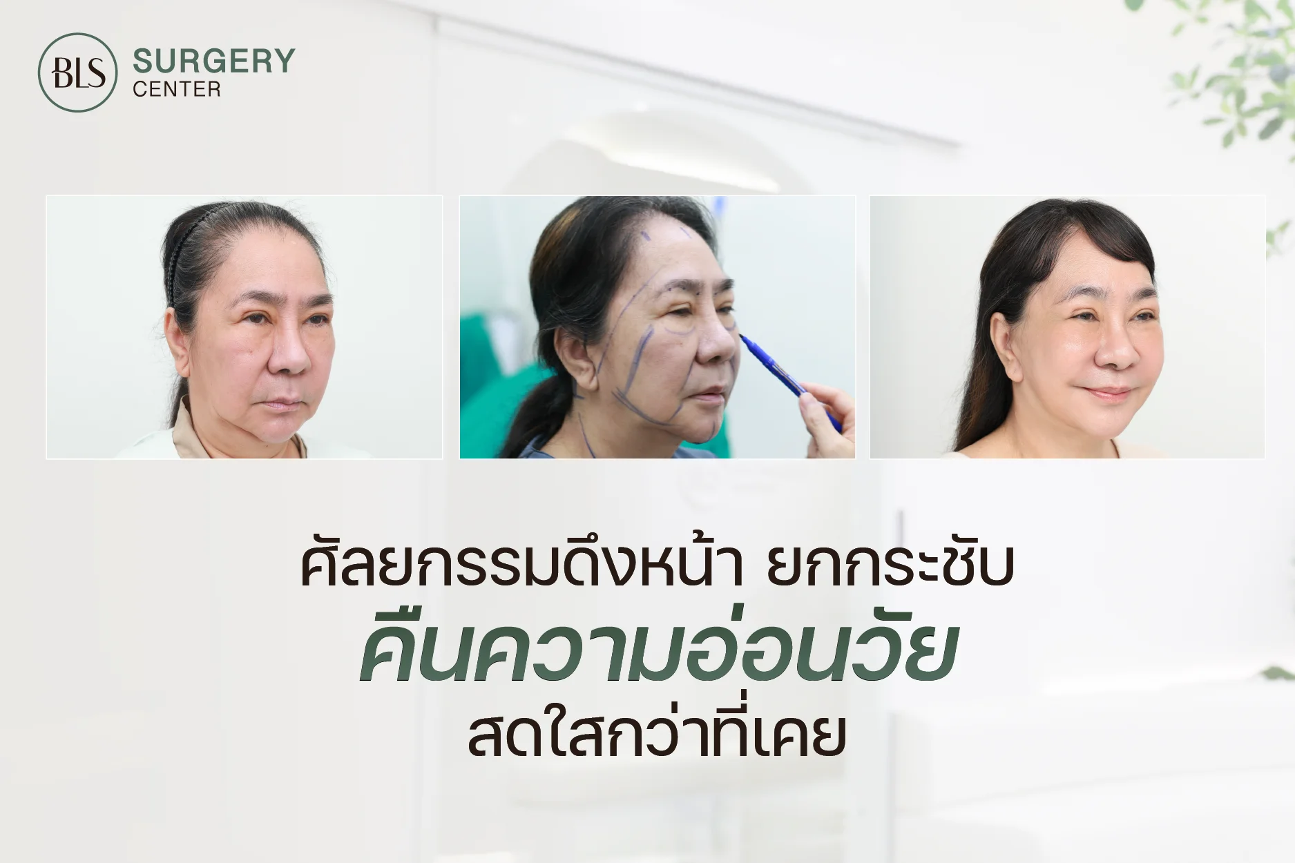 BLS Surgery Center ศัลยกรรมดึงหน้า ยกกระชับหน้า