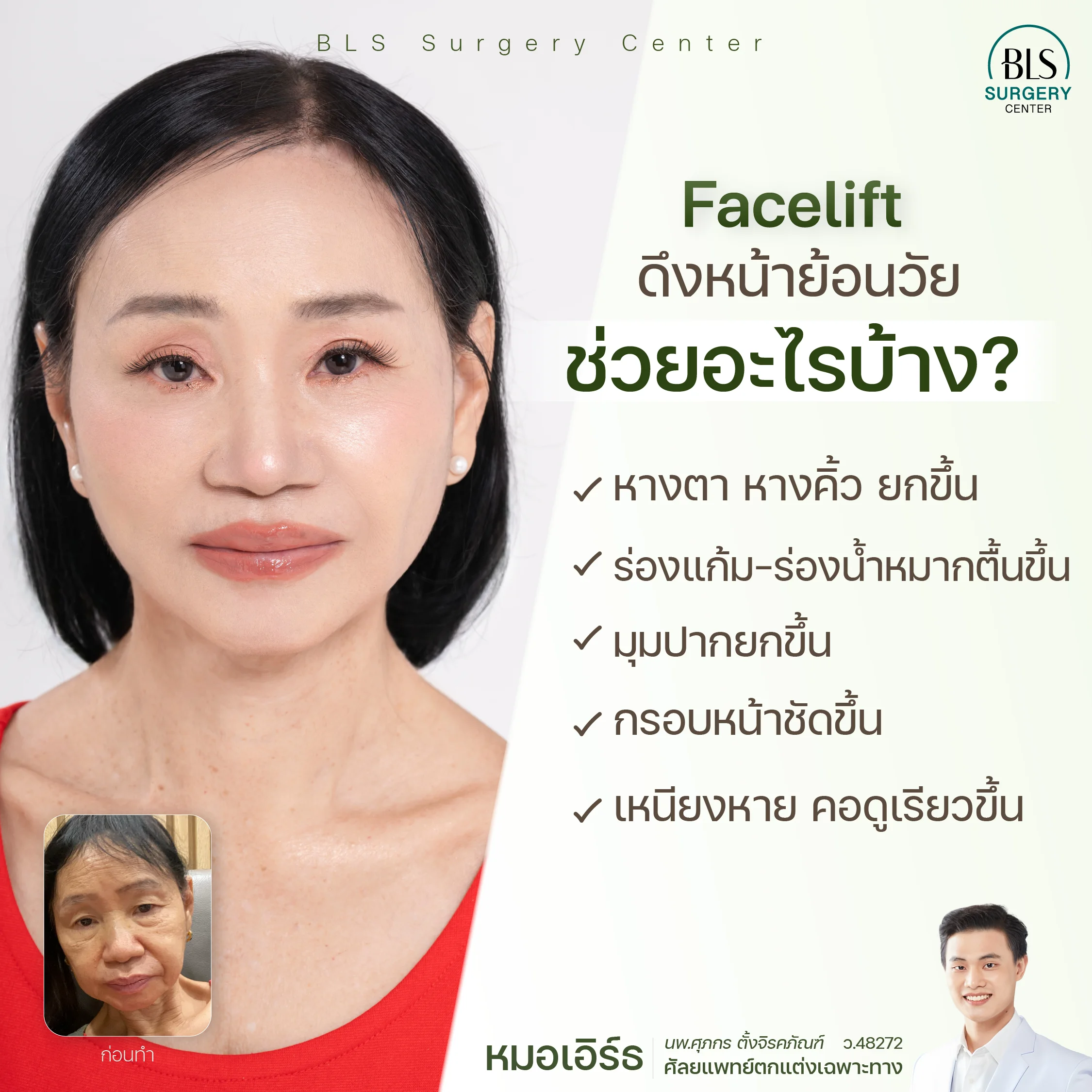  Face Lift ดึงหน้าย้อนวัย ช่วยอะไรบ้าง? 