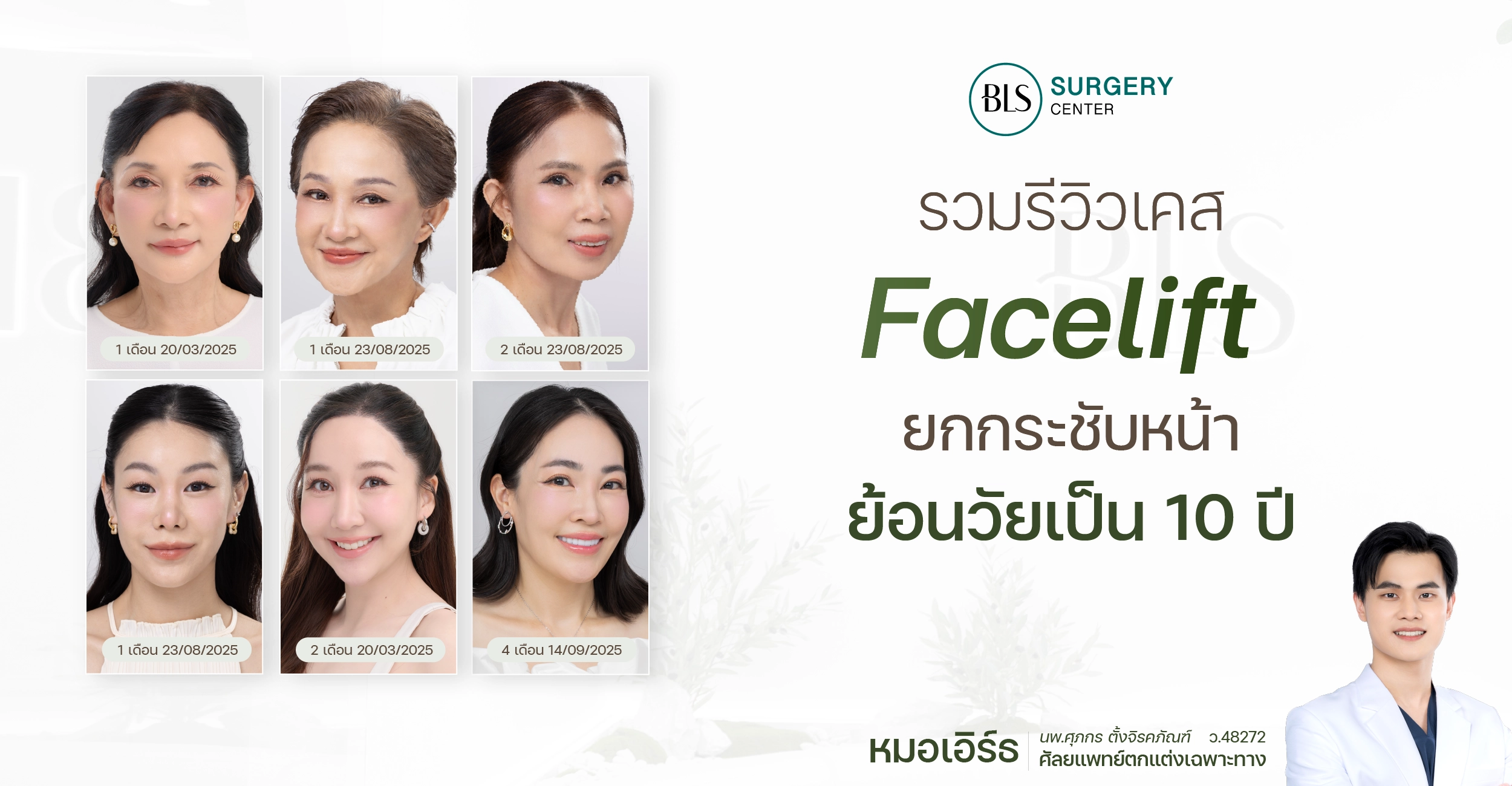 รวมรีวิวเคส Face Lift ยกกระชับหน้า ย้อนวัยเป็น 10 ปี โดยหมอเอิร์ธ