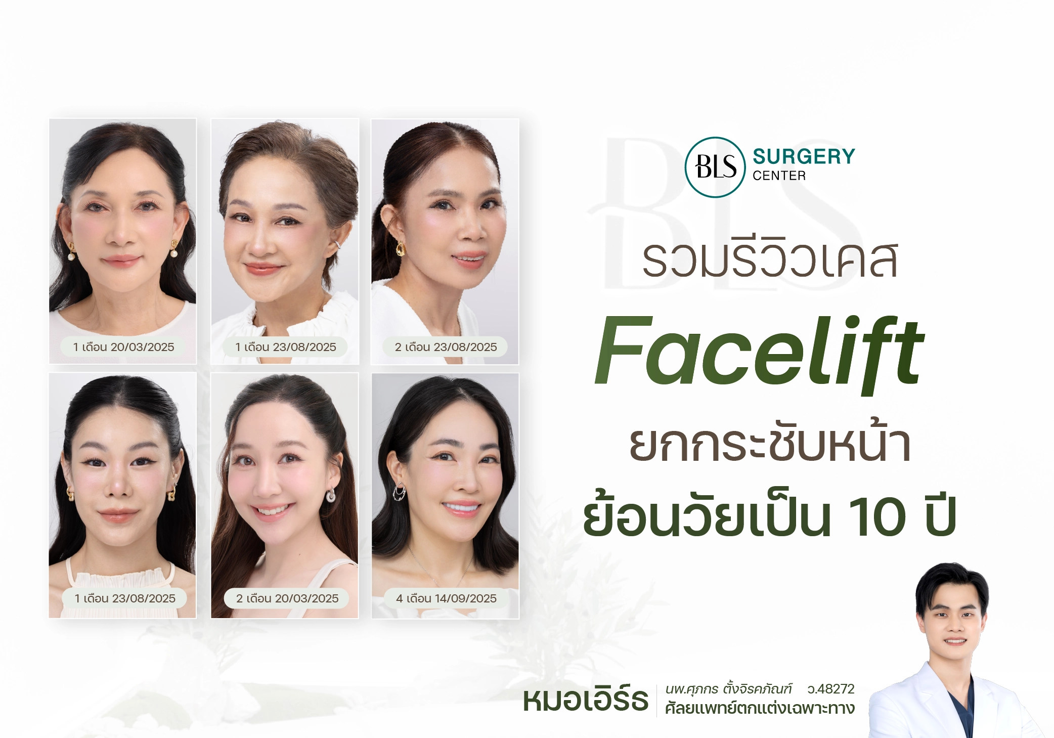 รวมรีวิวเคส Face Lift ยกกระชับหน้า ย้อนวัยเป็น 10 ปี โดยหมอเอิร์ธ